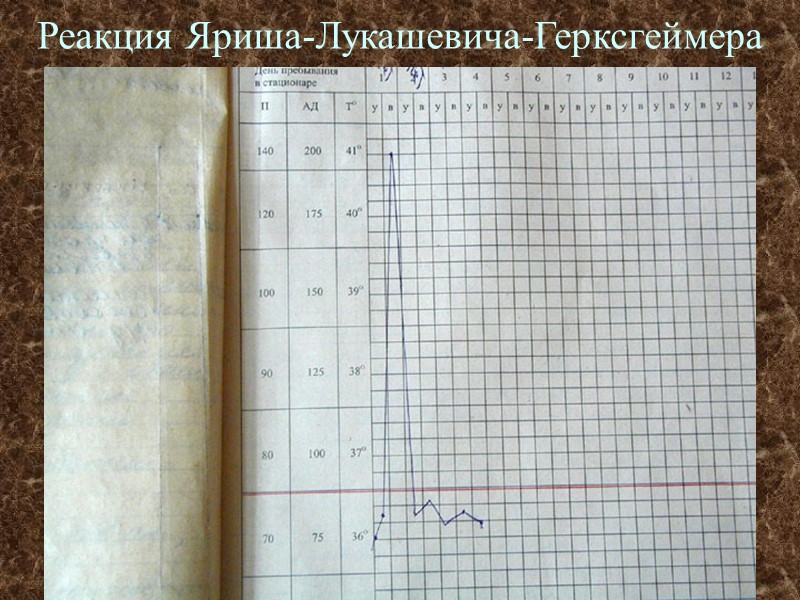 Реакция Яриша-Лукашевича-Герксгеймера